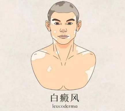 如何预防白癜风的扩散?
